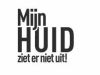 Mijn Huid Ziet Er Niet Uit! gemist